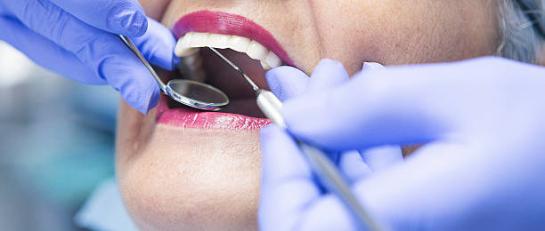 Best Urgent Care for Lost Fillings or Crowns in Leadville North, CO